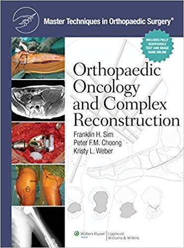 Master Techniques in Orthopaedic Surgery - Orthopaedic Oncology and Complex Reconstruction