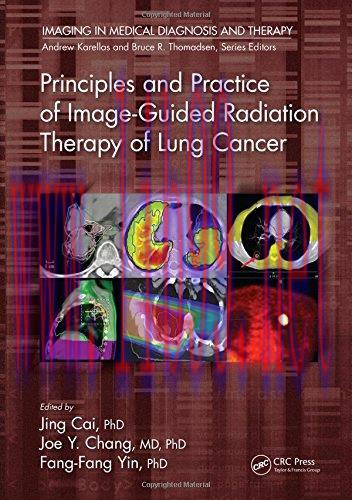 [AME]Principles and Practice of Image-Guided Radiation Therapy of Lung Cancer (PDF)