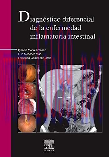 [AME]Diagn&oacute;stico diferencial de la enfermedad inflamatoria intestinal (Spanish Edition) (Origin...