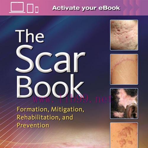 [PDF]The Scar Book: Formation, Mitigation, Rehabilitation and Prevention - Original PDF