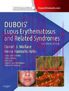 [AME]Dubois&rsquo; Lupus Erythematosus and Related Syndromes, 8th Edition (Original PDF)