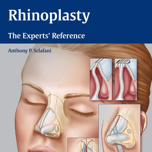 Rhinoplasty The Expert Reference - Anthony P. Sclafani