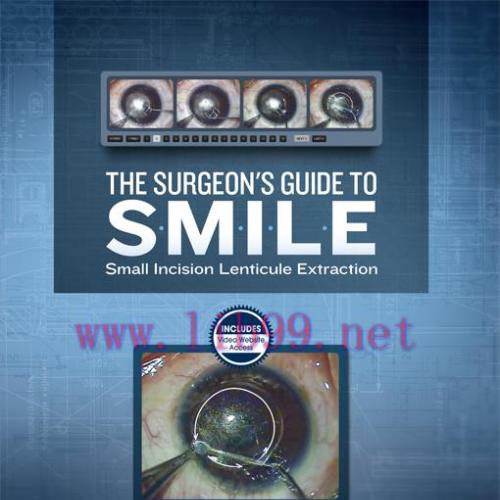 [AME]The Surgeon's Guide to SMILE (Original PDF)