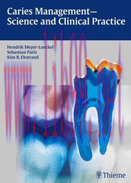 [AME]Caries Management &ndash; Science and Clinical Practice (ORIGINAL PDF from_ Publisher)
