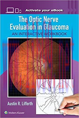 [EPUB]The Optic Nerve Evaluation in Glaucoma