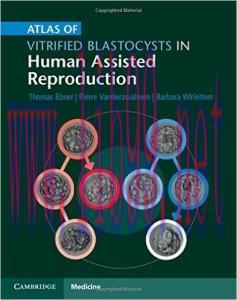 [AME]Atlas of Vitrified Blastocysts in Human Assisted Reproduction