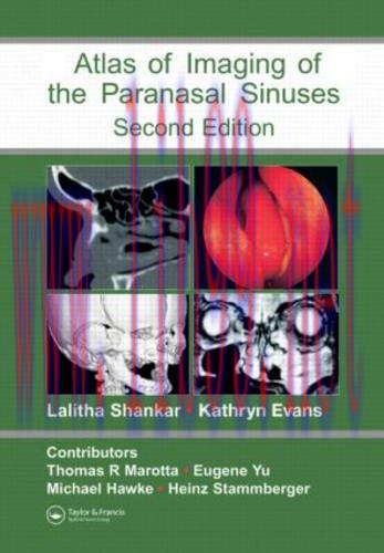 [AME]Atlas of Imaging of the Paranasal Sinuses, Second Edition (Original PDF)