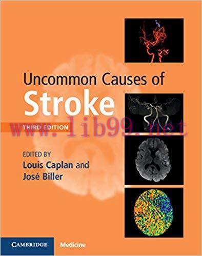 [PDF]Uncommon Causes of Stroke 3rd Edition