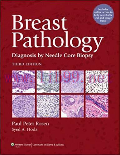[PDF]Breast Pathology - Diagnosis by Needle Core Biopsy, 3rd Edition+CHM版