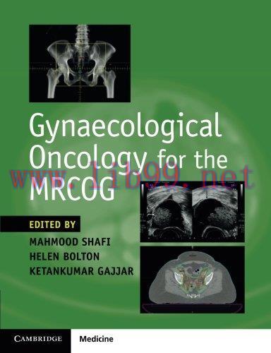 [AME]Gynaecological Oncology for the MRCOG (PDF)