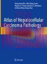 [PDF]Atlas of Hepatocellular Carcinoma Pathology
