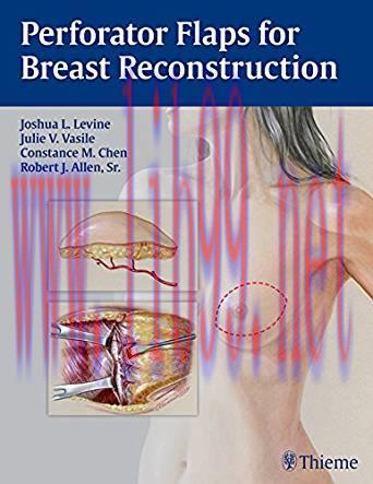 [PDF]Perforator Flaps for Breast Reconstruction