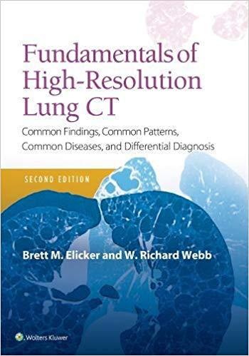 Fundamentals of High-Resolution Lung CT, 2nd Edition