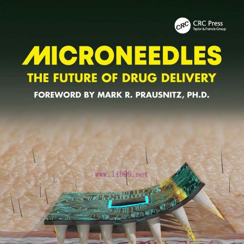 [AME]Microneedles: The Future of Drug Delivery (EPUB)