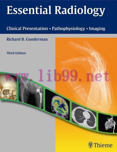 [AME]Essential Radiology: Clinical Presentation Pathophysiology Imaging 3rd Edition (Original P...