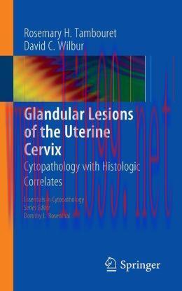 [AME]Glandular Lesions of the Uterine Cervix: Cytopathology with Histologic Correlates
