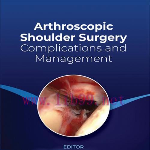 [AME]Arthroscopic Shoulder Surgery: Complications and Management (EPUB)