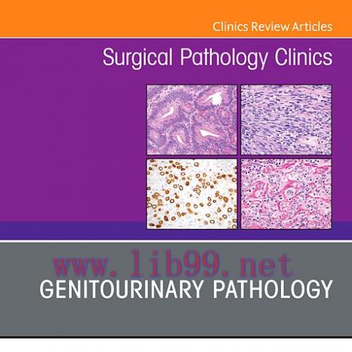 [PDF]Genitourinary Pathology Surgical Pathology Clinics