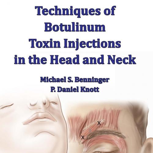 Techniques of Botulinum Toxin Injections in the Head and Neck