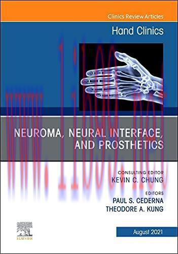 [AME]Neuroma, Neural interface, and Prosthetics, An Issue of Hand Clinics (Volume 37-3) (The Cl...