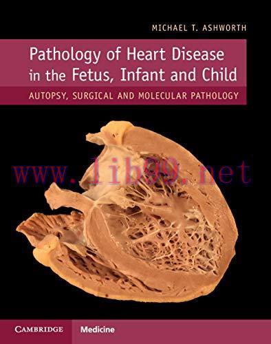 [FOX-Ebook]Pathology of Heart Disease in the Fetus, Infant and Child