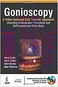 [AME]Gonioscopy:A Video Assisted Skill Transfer Approach (Videos Only)