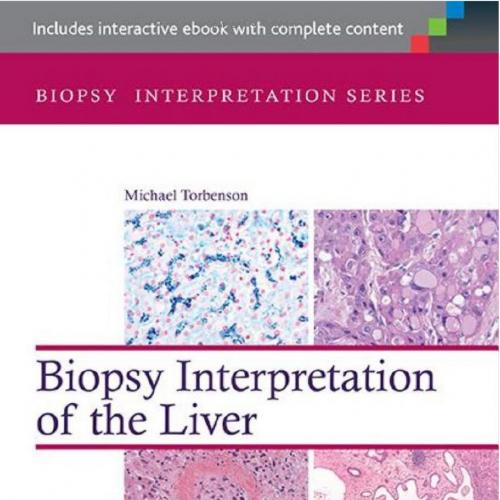 Biopsy Interpretation of the Liver 3rd Edition