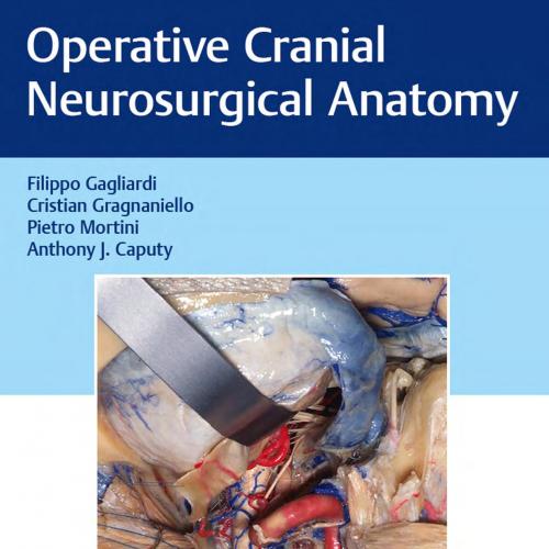 Operative Cranial Neurosurgical Anatomy