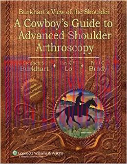 (PDF)Burkhart&rsquo;s View of the Shoulder: A Cowboy&rsquo;s Guide to Advanced Shoulder Arthroscopy 1st Edi...