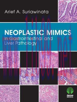 [AME]Neoplastic Mimics in Gastrointestinal and Liver Pathology