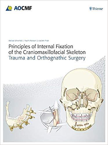 Principles of Internal Fixation of the Craniomaxillofacial Skeleton