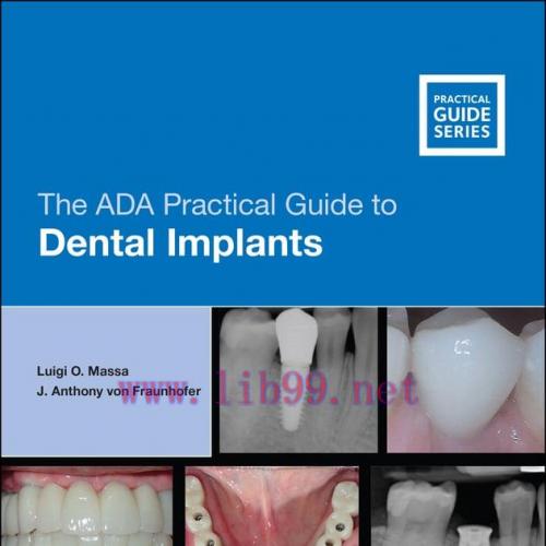 [AME]The ADA Practical Guide to Dental Implants (EPUB)