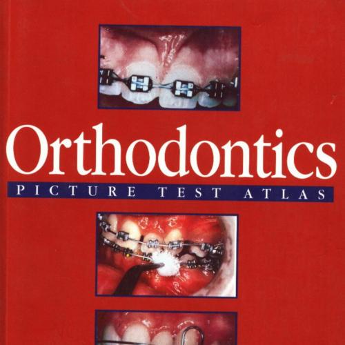 Orthodontics Picture Test Atlas