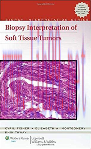 [PDF]Biopsy Interpretation of Soft Tissue Tumors
