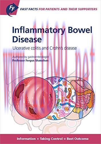 [AME]Fast Facts: Inflammatory Bowel Disease for Patients and their Supporters: Ulcerative colit...