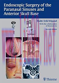[PDF]Endoscopic Surgery of the Paranasal Sinuses and Anterior Skull Base, 2e [Thieme] [2008]