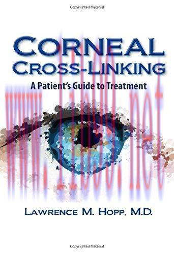 [AME]Corneal Cross-Linking: Treatment for Cornea Disease (PDF)