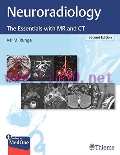 [AME]Neuroradiology: The Essentials with MR and CT, 2ed (Original PDF)