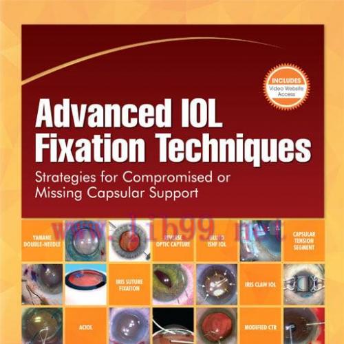 [AME]Advanced IOL Fixation Techniques: Strategies for Compromised or Missing Capsular Support (...