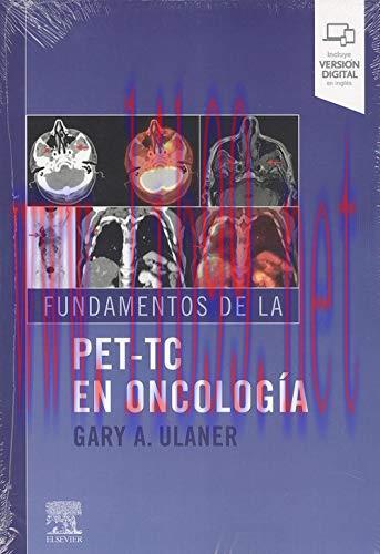 [AME]Fundamentos de la PET-TC en oncolog&iacute;a (Spanish Edition) (True PDF)