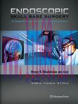 [PDF]Endoscopic Skull Base Surgery: A Comprehensive Guide with Illustrative Cases