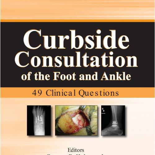 Curbside Consultation of the Foot and Ankle 49 Clinical Questions
