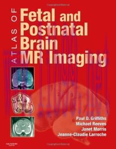 [AME]Atlas of Fetal and Postnatal Brain MR Imaging (Original PDF)