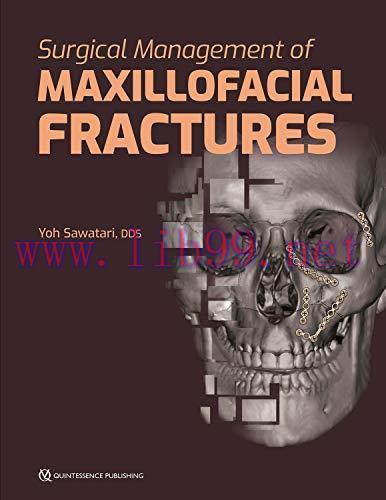 [AME]Surgical Management of Maxillofacial Fractures (PDF)