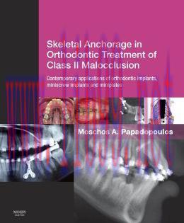 [AME]Skeletal Anchorage in Orthodontic Treatment of Class II Malocclusion: Contemporary applica...