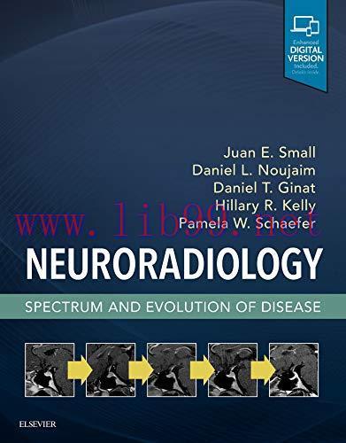 [AME]Neuroradiology: Spectrum and Evolution of Disease (ePUB)