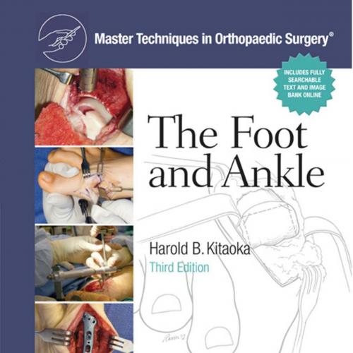 Master Techniques in Orthopaedic Surgery_ The Foot and Ankle - Wei Zhi