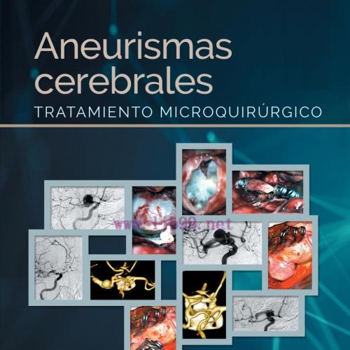 [AME]Aneurismas cerebrales: Tratamiento microquir&uacute;rgico (Original PDF)