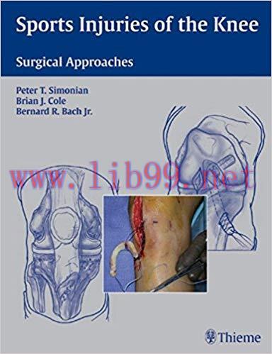 [PDF]Sports Injuries of the Knee - Surgical Approaches