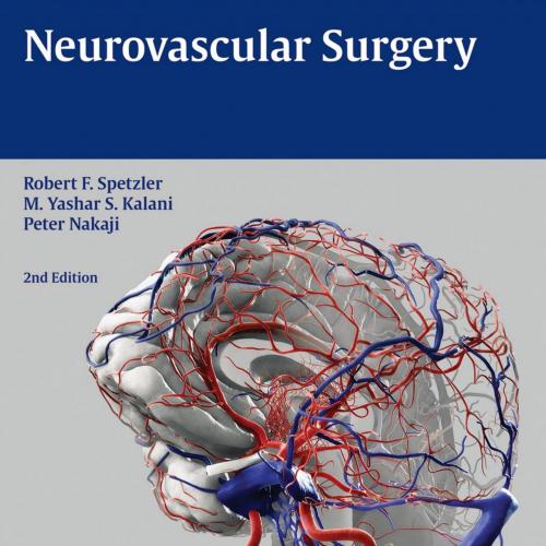 Neurovascular Surgery 2nd Edition